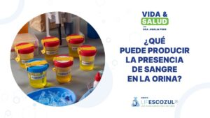 presencia-de-sangre-en-la-orina-vida-y-salud